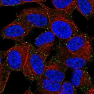 Anti-LIMD2 antibody produced in rabbit 