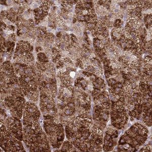 Anti-LIMS1 antibody produced in rabbit 