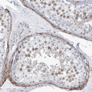 Anti-LIN9 antibody produced in rabbit 