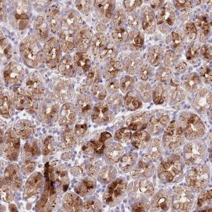 Anti-LIPJ antibody produced in rabbit 