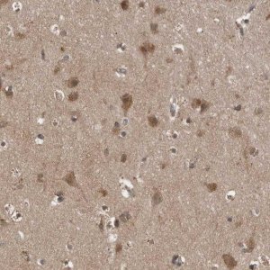 Anti-LLGL1 antibody produced in rabbit 