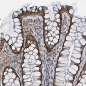Anti-LMBRD2 antibody produced in rabbit 