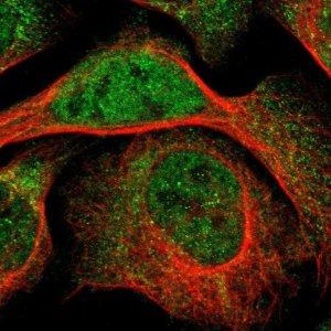 Anti-LMBRD2 antibody produced in rabbit 