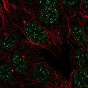 Anti-LMNTD1 antibody produced in rabbit 