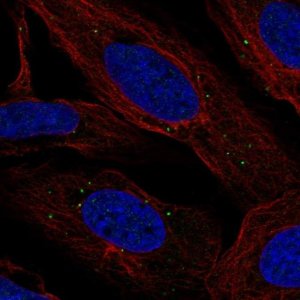 Anti-LMNTD2 antibody produced in rabbit 