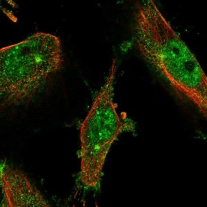 Anti-LMTK2 antibody produced in rabbit 