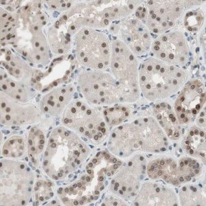Anti-LONP2 antibody produced in rabbit HPA008862-100UL