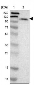 Anti-LONP2 antibody produced in rabbit HPA008862-100UL