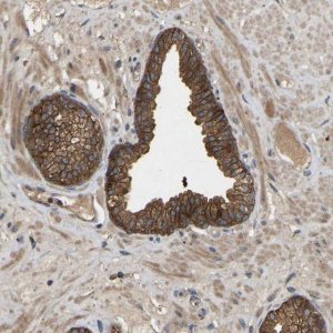 Anti-LPAR2 antibody produced in rabbit 