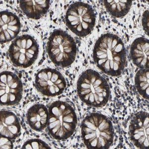 Anti-LPAR5 antibody produced in rabbit 