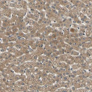 Anti-LPGAT1 antibody produced in rabbit 