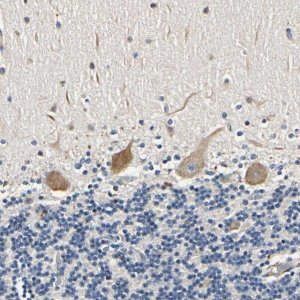 Anti-LPGAT1 antibody produced in rabbit 