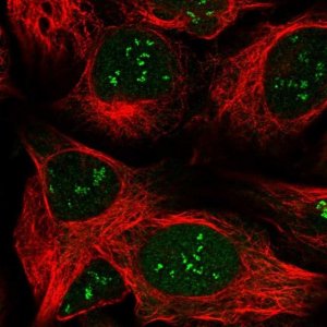 Anti-LPIN1 antibody produced in rabbit 