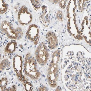 Anti-LRBA antibody produced in rabbit 