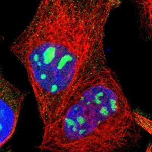 Anti-LRCH2 antibody produced in rabbit 