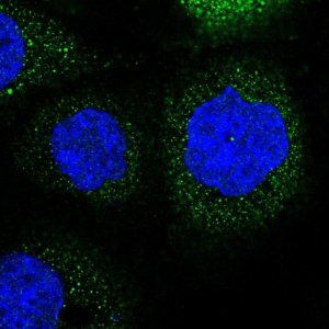 Anti-LRCH3 antibody produced in rabbit 