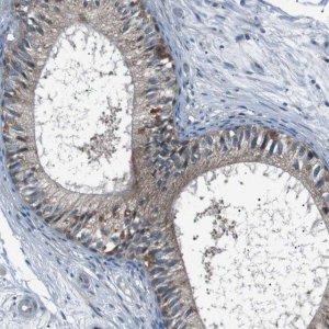 Anti-LRIG2 antibody produced in rabbit 