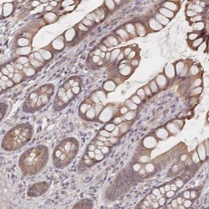 Anti-LRP5 antibody produced in rabbit 