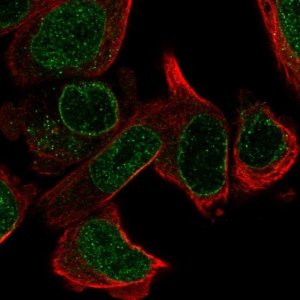 Anti-LRR1 antibody produced in rabbit 