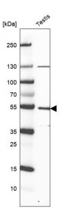Anti-LRR1 antibody produced in rabbit 