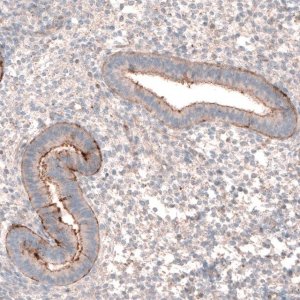 Anti-LRRC15 antibody produced in rabbit 