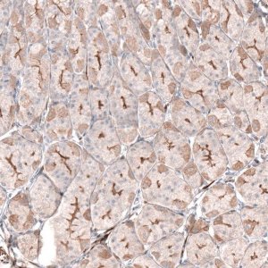 Anti-LRRC15 antibody produced in rabbit 