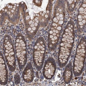 Anti-LRRC2 antibody produced in rabbit 