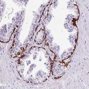 Anti-LRRC26 antibody produced in rabbit 