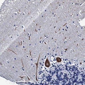 Anti-LRRC30 antibody produced in rabbit 