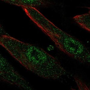 Anti-LRRC32 antibody produced in rabbit 