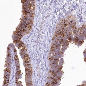 Anti-LRRC34 antibody produced in rabbit 