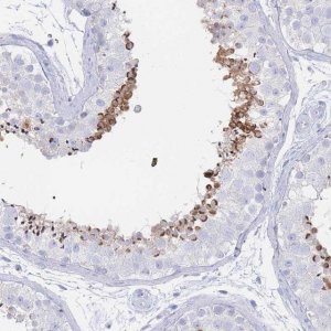 Anti-LRRC37A2 antibody produced in rabbit 