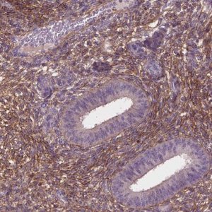 Anti-LRRC3C antibody produced in rabbit 