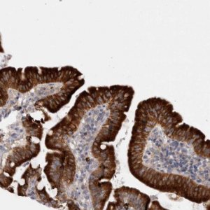 Anti-LRRC40 antibody produced in rabbit 