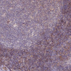 Anti-LRRC41 antibody produced in rabbit 