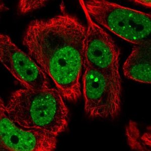 Anti-LRRC41 antibody produced in rabbit 