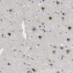Anti-LRRC49 antibody produced in rabbit 