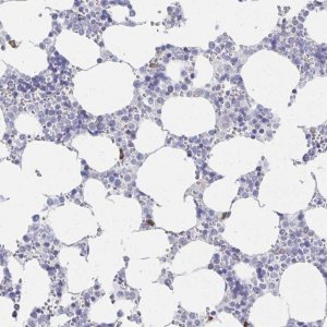 Anti-LRRC58 antibody produced in rabbit 