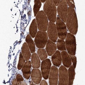 Anti-LRRC63 antibody produced in rabbit 