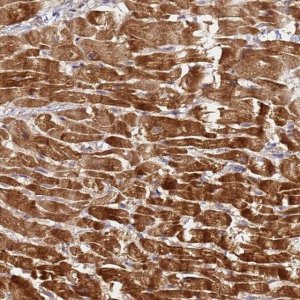 Anti-LRRC69 antibody produced in rabbit 