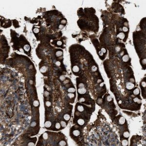 Anti-LRRC72 antibody produced in rabbit 
