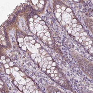 Anti-LRRC9 antibody produced in rabbit 
