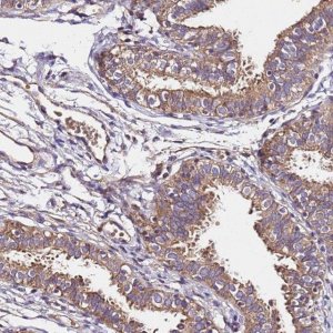 Anti-LRRIQ1 antibody produced in rabbit 