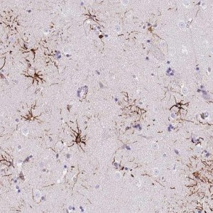 Anti-LRRN3 antibody produced in rabbit 
