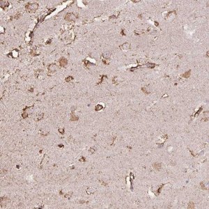 Anti-LRTM2 antibody produced in rabbit HPA055094-100UL