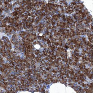 Anti-LRWD1 antibody produced in rabbit HPA029916-100UL