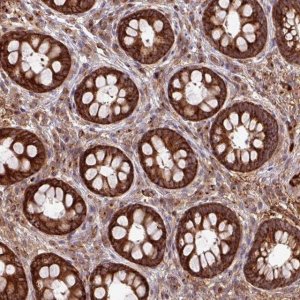 Anti-LSM12 antibody produced in rabbit 
