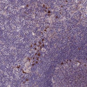 Anti-LTB antibody produced in rabbit 