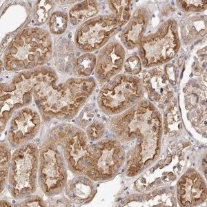 Anti-LTV1 antibody produced in rabbit 