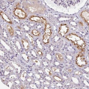 Anti-LY9 antibody produced in rabbit 